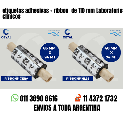 etiquetas adhesivas ribbon de 110 mm Laboratorios clínicos